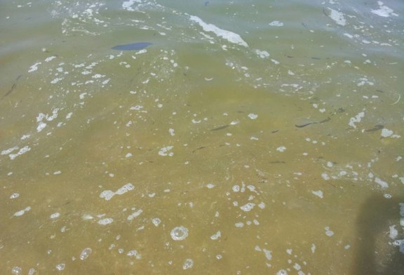 Acqua di fogna mista all’acqua potabile, disastro in via Bolognetta