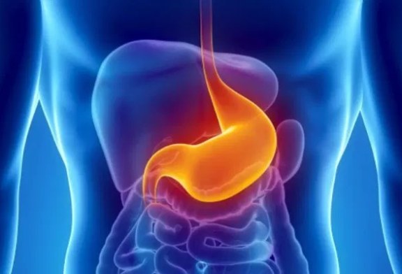 MRGE: quel fastidioso reflusso